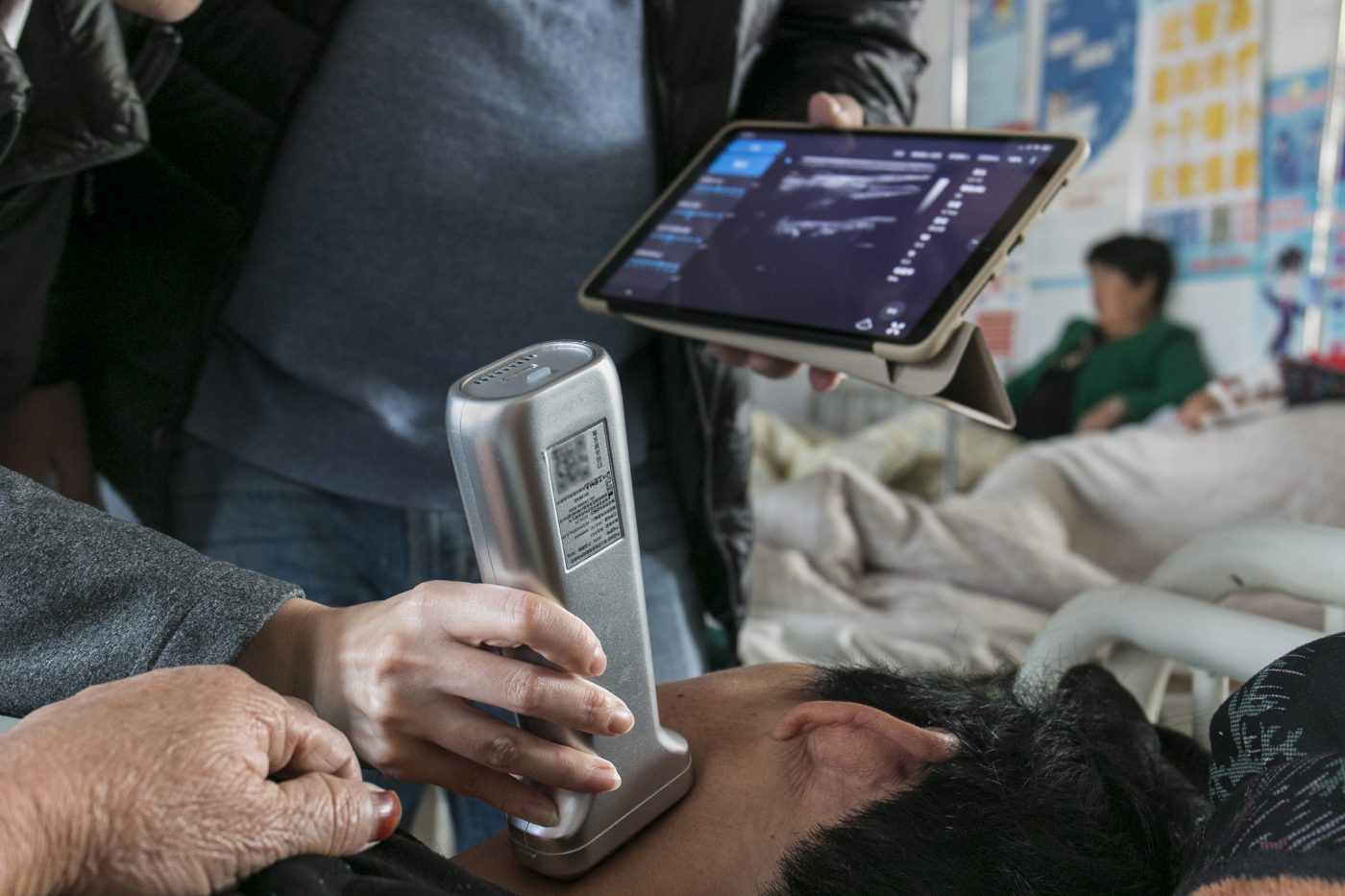 AI活用の超音波診断、20以上の疾患の診断補助に　検査精度の低下を防ぐ