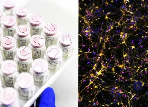 中国のiPS細胞薬開発が加速。睿健医薬「日米と肩を並べる水準に」、シリーズBで累計60億円超を調達