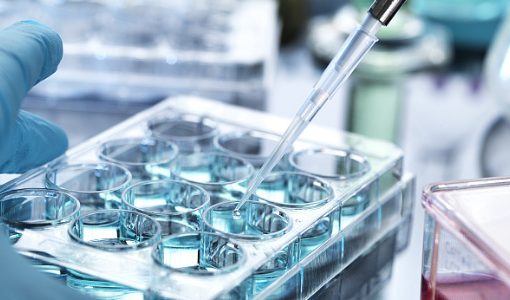 1回330万円の幹細胞治療、中国特区で始動。吉美瑞生が挑む臓器修復の商用化