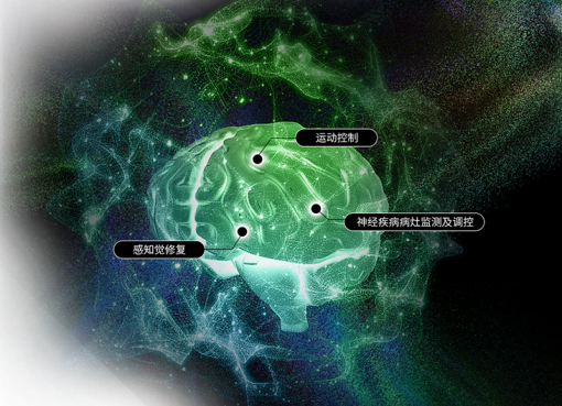 中国BMI「StairMed」、約120億円調達　埋込型システム臨床数で米Neuralinkに迫る